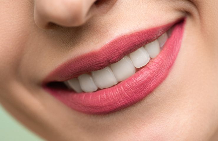 denti gialli trucco per sbiancarli