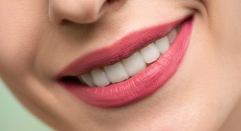 Denti gialli? Ecco come mascherarli con un trucco che ti salverà l’estate!