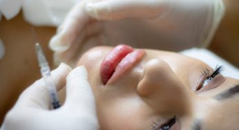 Antirughe più efficace del botox: è il trattamento ai fili di collagene – INFO
