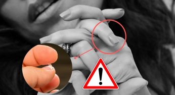 Difetti sulle unghie: questi in particolare suggeriscono gravi patologie – OCCHI APERTI