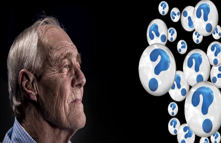 alzheimer ricerca scientifica sintomi