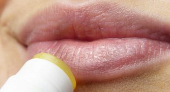 Labbra secche, questi rimedi 100% naturali risolveranno subito il problema