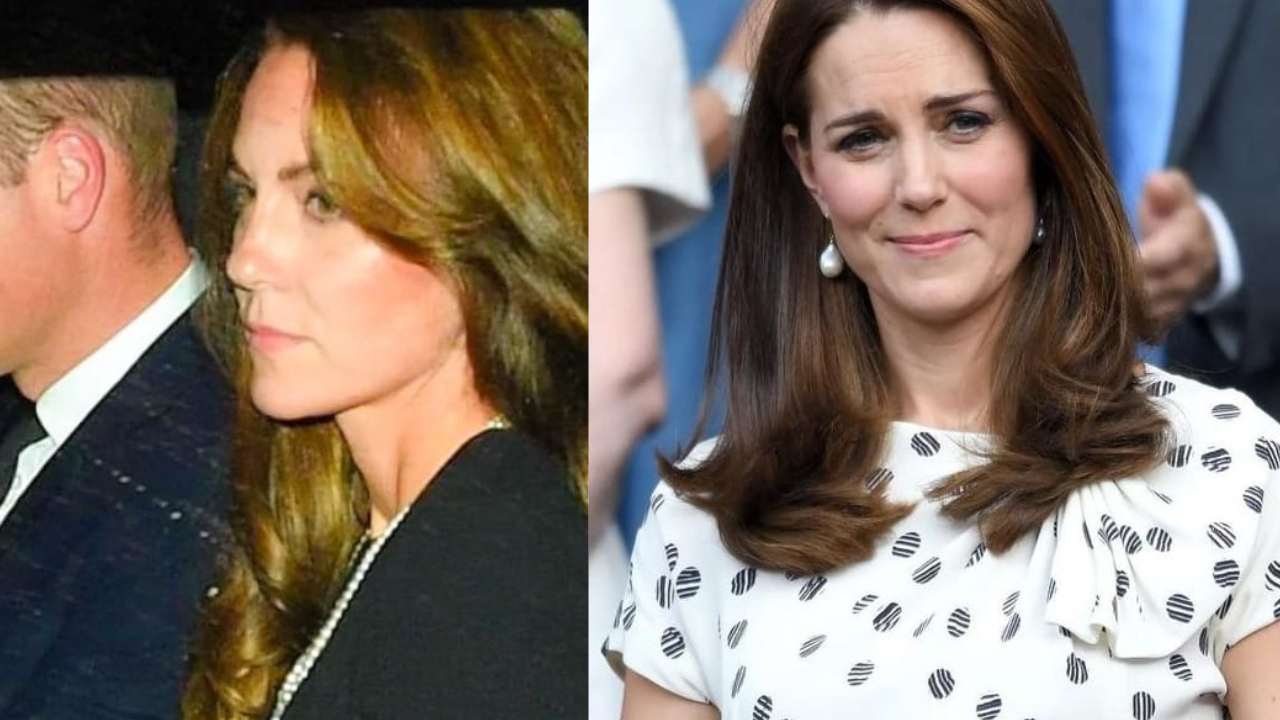 Kate Middleton: preoccupazione totale