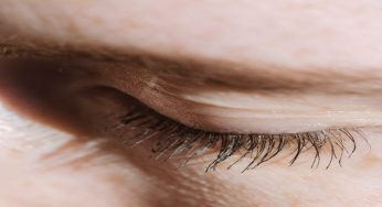 Addio couperose e rossore, i migliori sieri viso per le pelli delicate sono questi