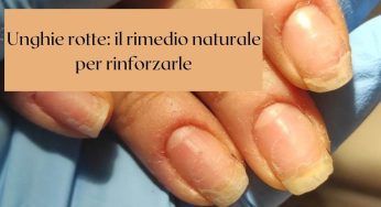 Unghie rotte: niente panico! Con questo rimedio naturale torneranno più forti di prima