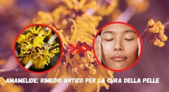Amamelide, il rimedio antico per la cura della pelle: il segreto della nuova skincare