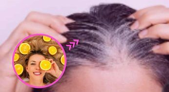 Capelli grigi e calvizie, cause e rimedi: con questi metodi saranno solo un ricordo