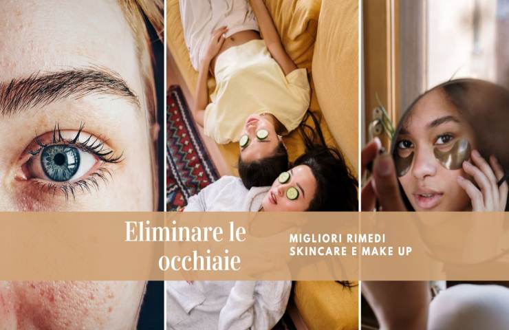 eliminare le occhiaie rimedi skincare e make up