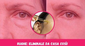 Elimina le rughe con questi ingredienti che hai già a casa tua!