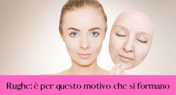 Rughe, clamoroso: è questo il vero motivo per cui compaiono!!!!