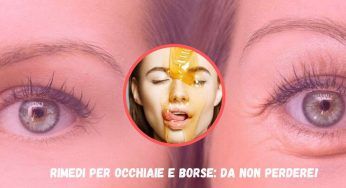 Occhiaie e borse sotto gli occhi: 6 rimedi naturali super efficaci che hai a casa tua!