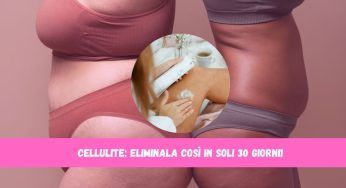 Cellulite, nemico comune delle donne: eliminalo con questi suggerimenti entro 30 giorni!