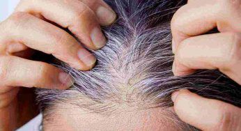 Capelli bianchi, non solo quando si invecchia: le cause e come poterlo evitare