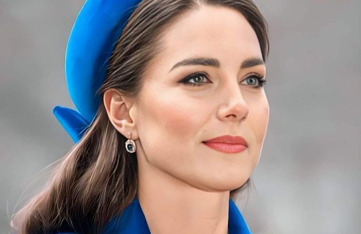Le creme "botox like" conquistano Kate Middleton: di cosa si tratta 
